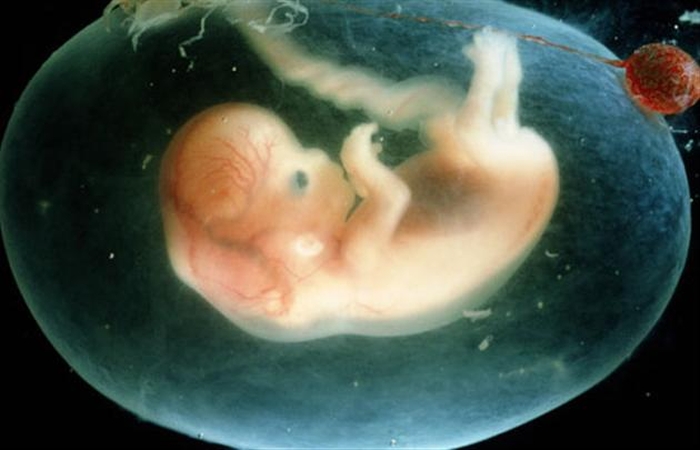 ембріон людини