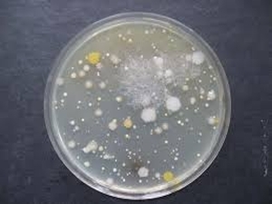 колонії бактерій