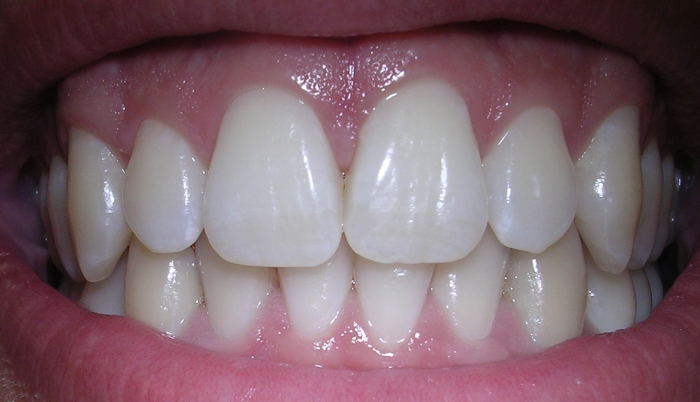 зуби людини