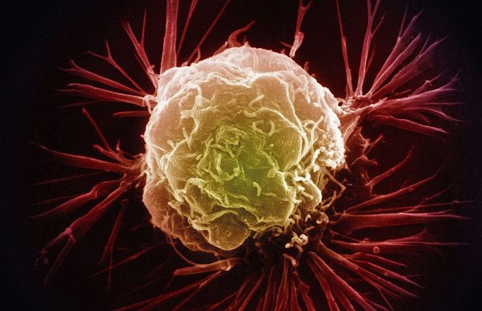 ракова клітина
