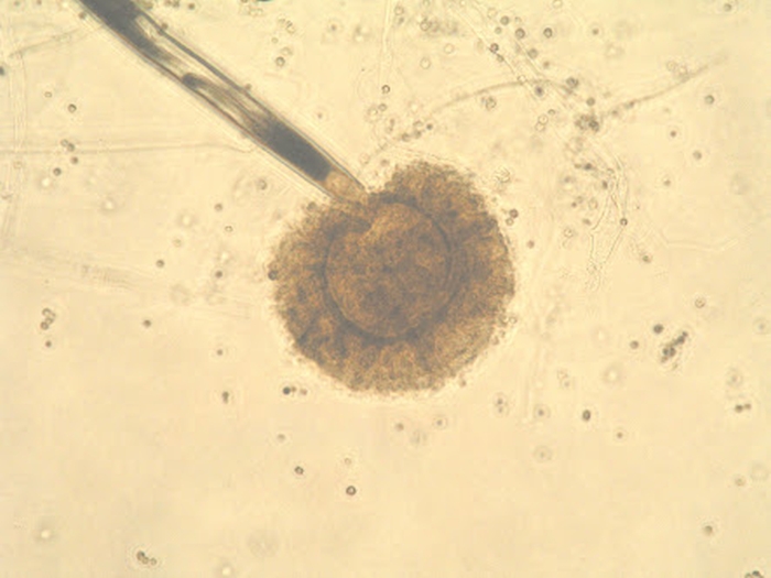 Aspergillus tubingensis